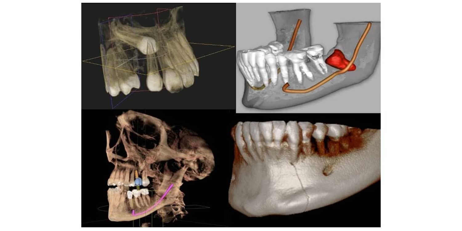 Image for CBCT Scan